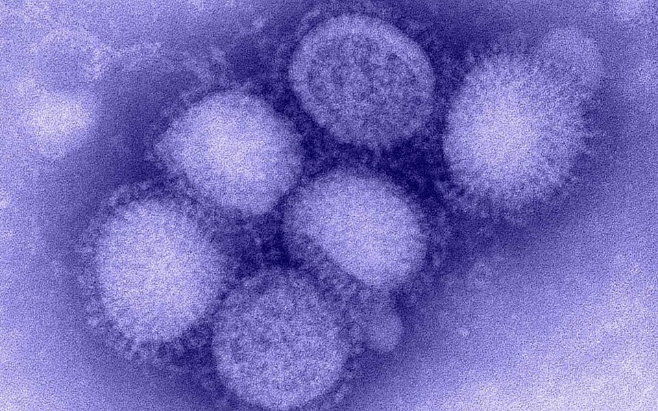 H1 N1 influenza virus